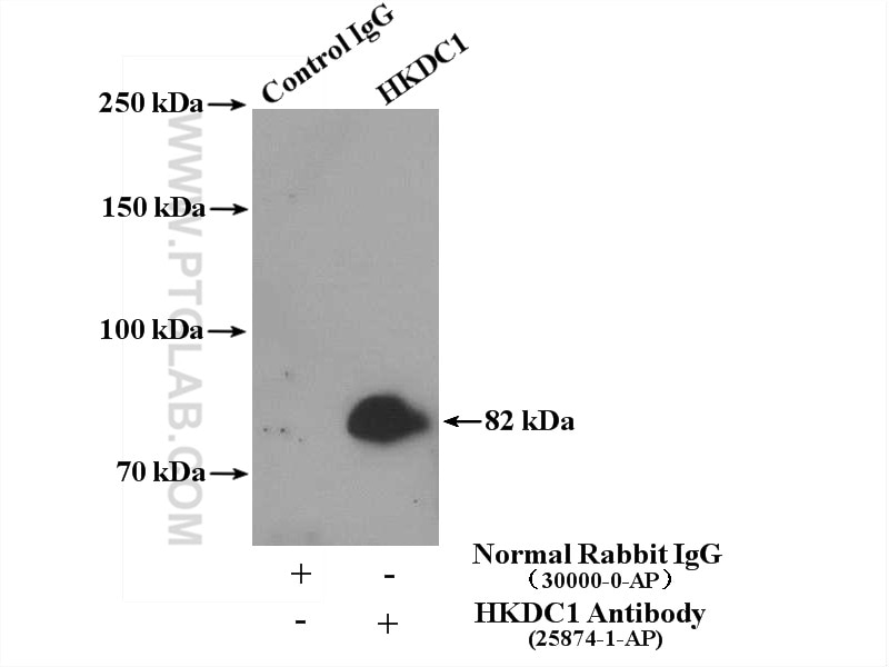 Immunoprecipitation (IP) experiment of mouse skeletal muscle tissue using HKDC1 Polyclonal antibody (25874-1-AP)