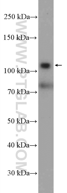 Western Blot (WB) analysis of A549 cells using HKDC1 Polyclonal antibody (25874-1-AP)