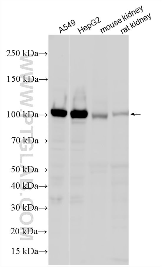 Western Blot (WB) analysis of various lysates using HKDC1 Polyclonal antibody (25874-1-AP)
