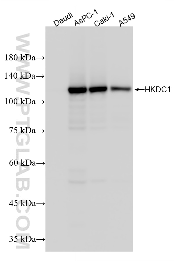 Western Blot (WB) analysis of various lysates using HKDC1 Recombinant monoclonal antibody (87988-1-RR)