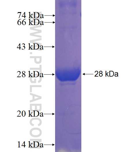 HKDC1 fusion protein Ag23045 SDS-PAGE