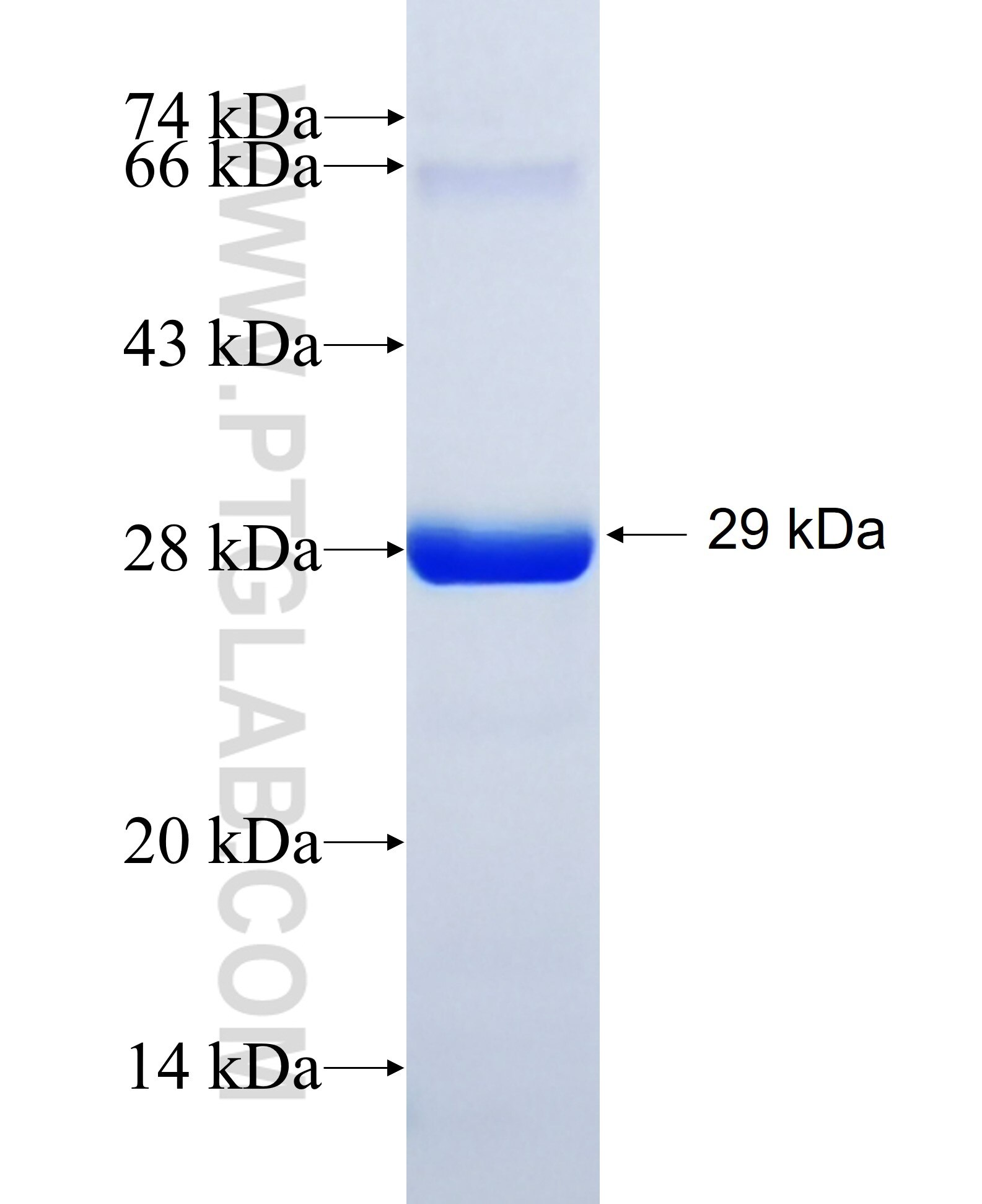 HKDC1 fusion protein Ag34543 SDS-PAGE HKDC1 fusion protein Ag34543 SDS-PAGE
