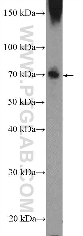 Western Blot (WB) analysis of HEK-293 cells using HKR1 Polyclonal antibody (14902-1-AP)