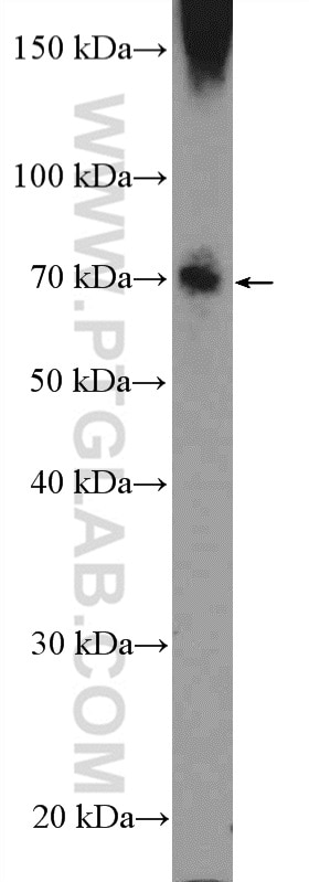 WB analysis of HEK-293 using 14902-1-AP