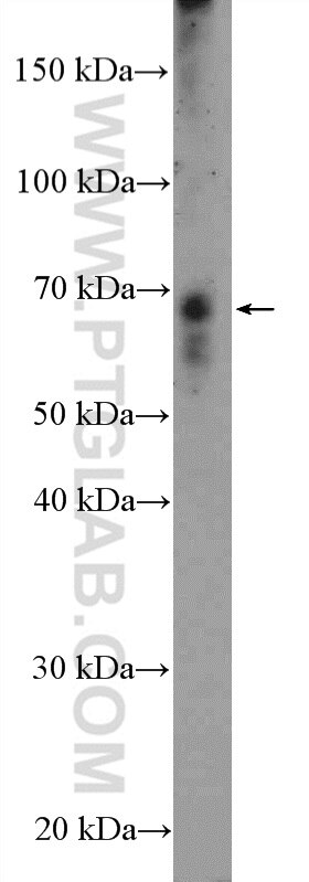 Western Blot (WB) analysis of HeLa cells using HKR1 Polyclonal antibody (14902-1-AP)