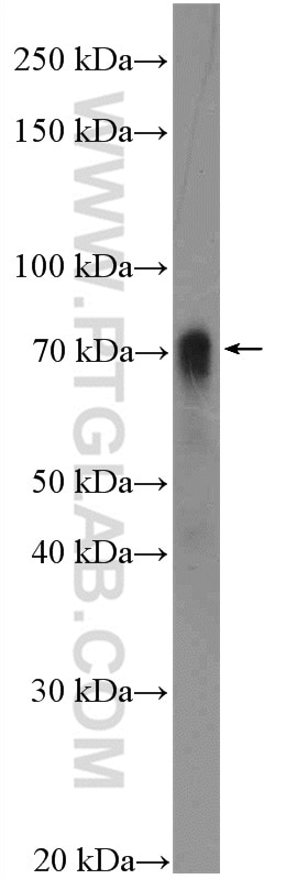 Western Blot (WB) analysis of COLO 320 cells using HKR1 Polyclonal antibody (14902-1-AP)