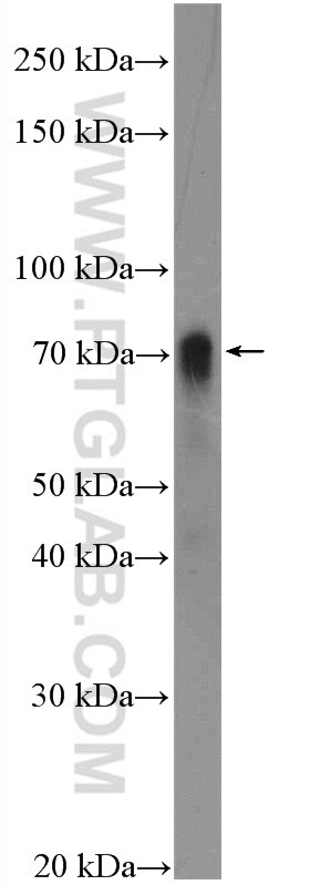 WB analysis of COLO 320 using 14902-1-AP