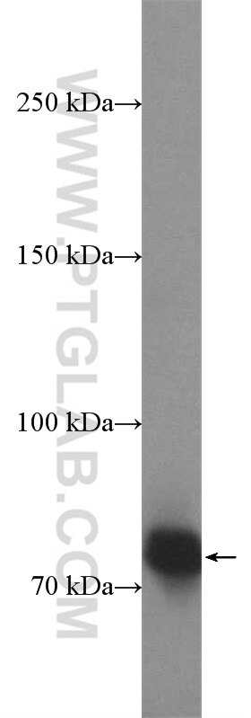 Western Blot (WB) analysis of COLO 320 cells using HKR1 Polyclonal antibody (14902-1-AP)