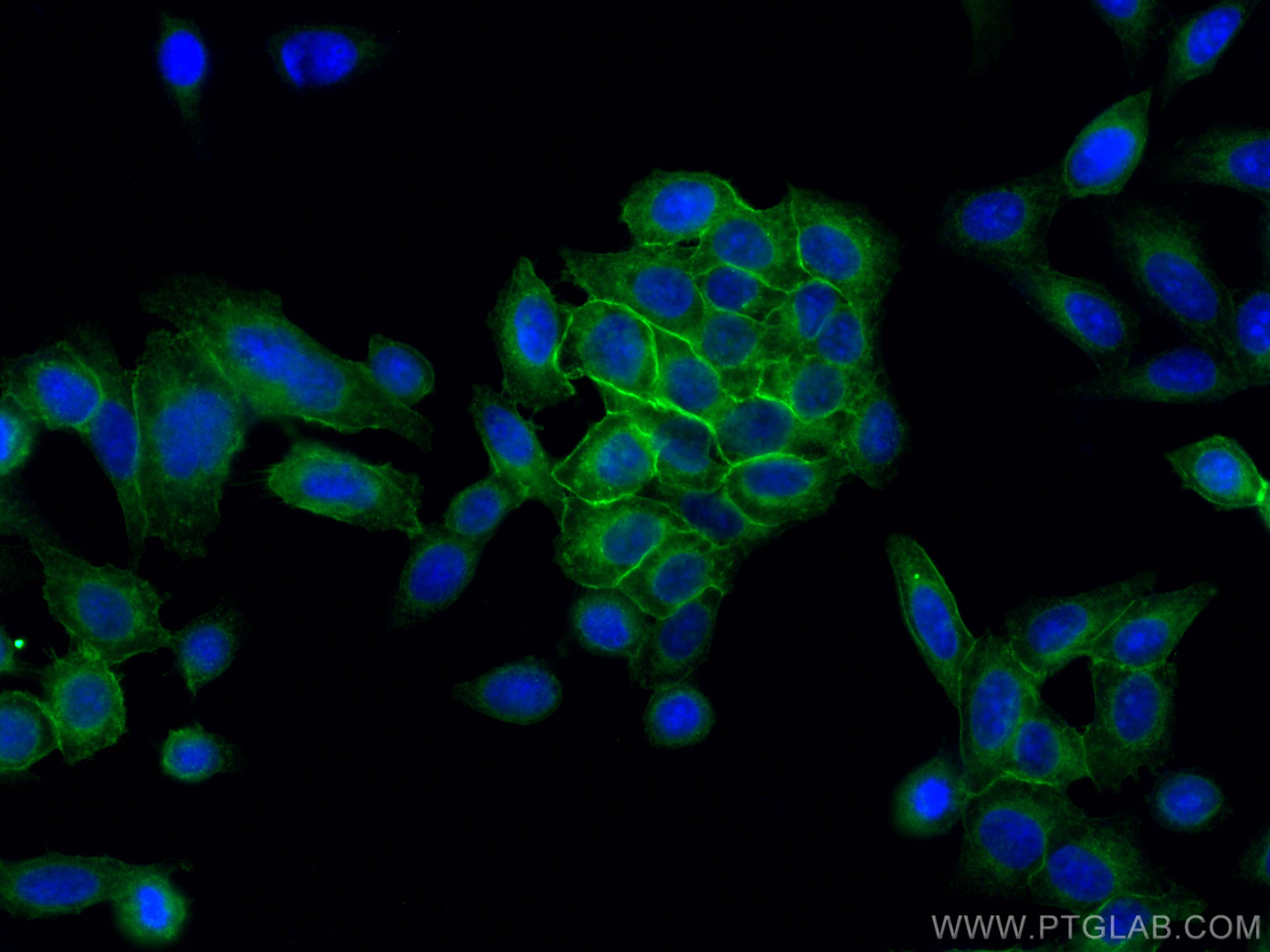 Immunofluorescence (IF) / fluorescent staining of HepG2 cells using HLA class I ABC Polyclonal antibody (15240-1-AP)