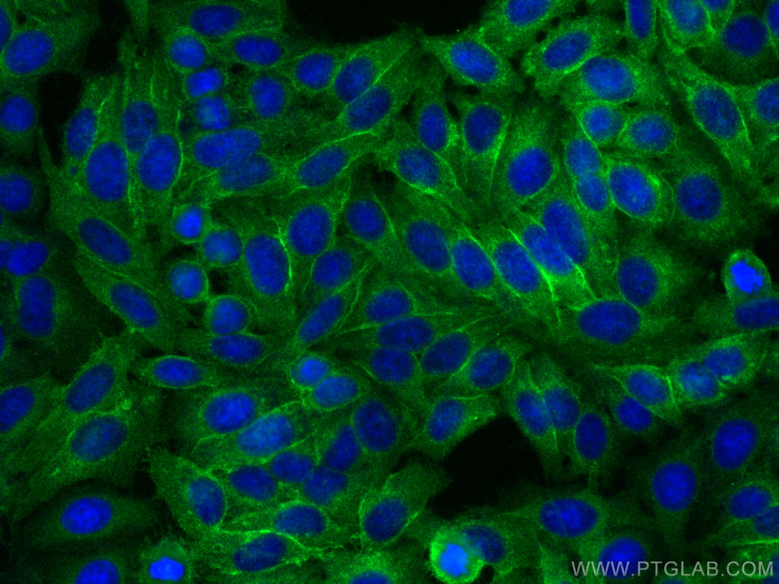 Immunofluorescence (IF) / fluorescent staining of HepG2 cells using HLA class I ABC Polyclonal antibody (15240-1-AP)