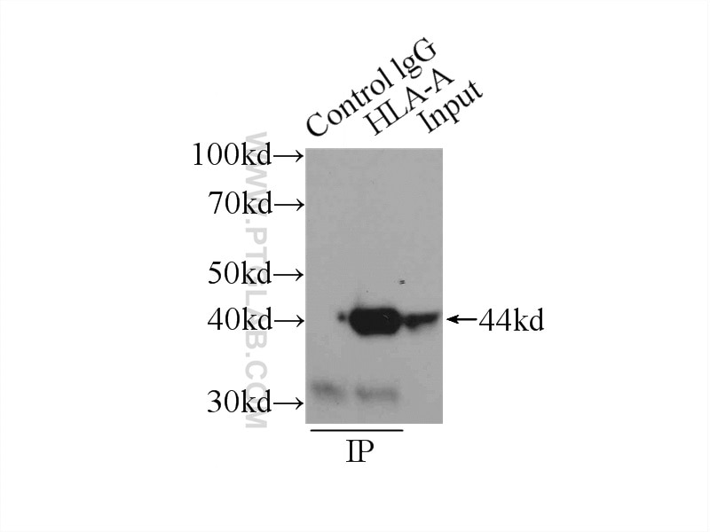 Immunoprecipitation (IP) experiment of HepG2 cells using HLA class I ABC Polyclonal antibody (15240-1-AP)