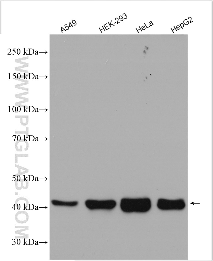 Western Blot (WB) analysis of various lysates using HLA class I ABC Polyclonal antibody (15240-1-AP)