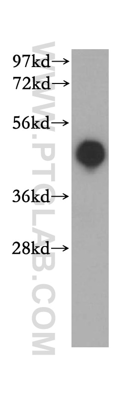 HLA class I ABC Polyclonal antibody