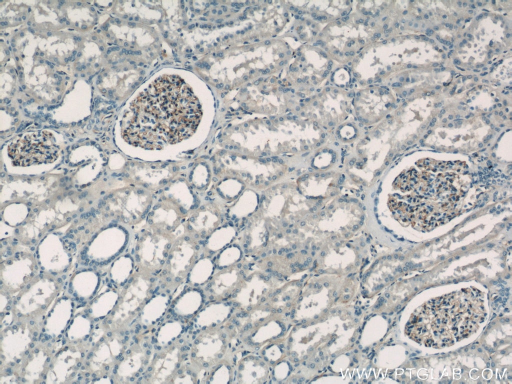 Immunohistochemistry (IHC) staining of human kidney tissue using HLA-A Polyclonal antibody (55383-1-AP)