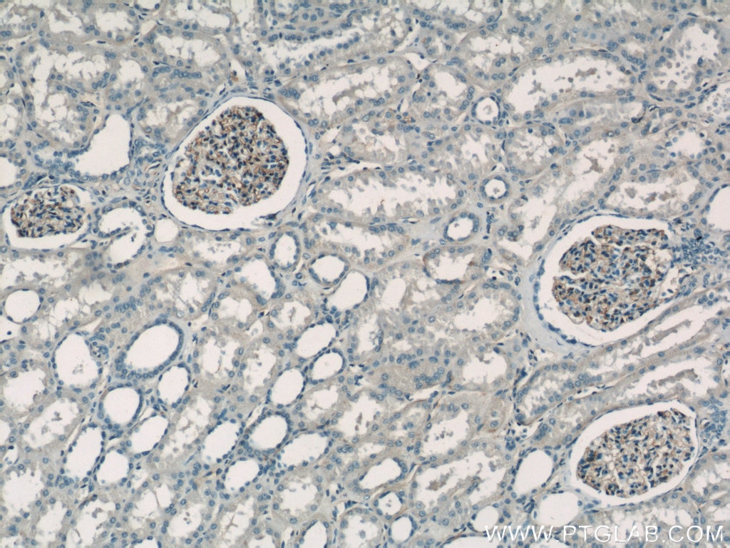 IHC staining of human kidney using 55383-1-AP