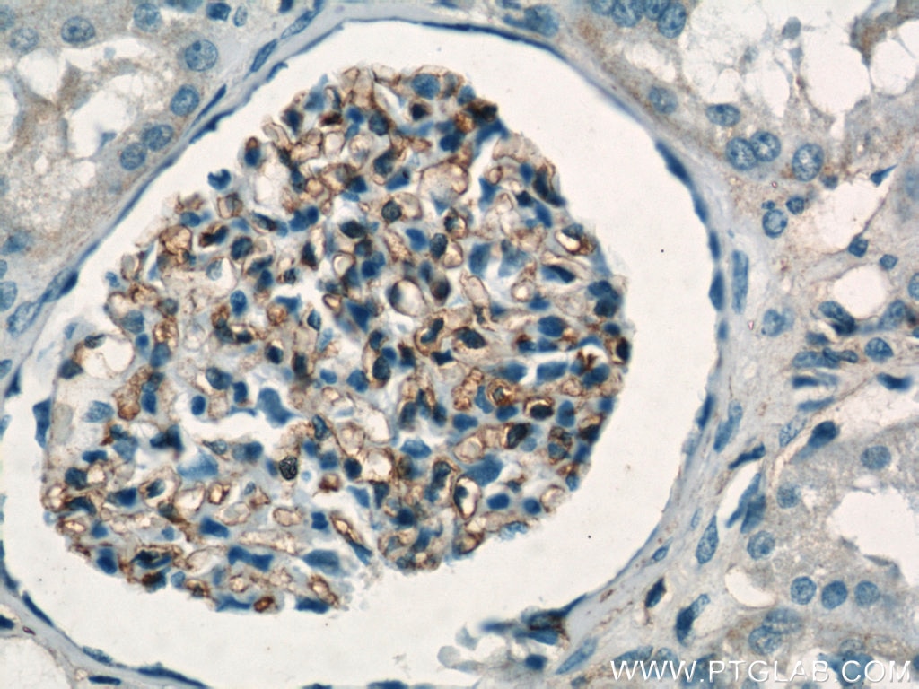 Immunohistochemistry (IHC) staining of human kidney tissue using HLA-A Polyclonal antibody (55383-1-AP)