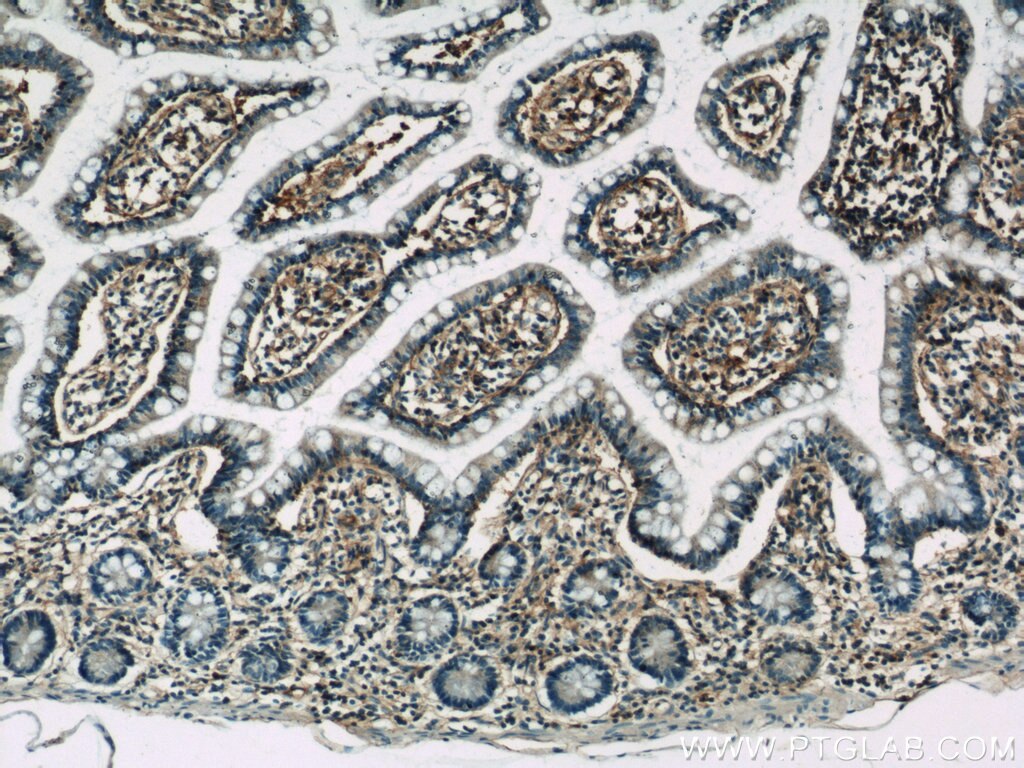 Immunohistochemistry (IHC) staining of human small intestine tissue using HLA-A Polyclonal antibody (55383-1-AP)