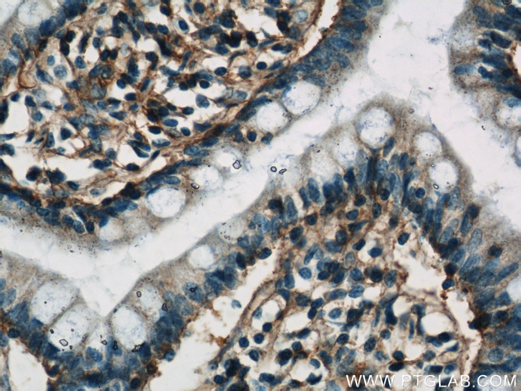 Immunohistochemistry (IHC) staining of human small intestine tissue using HLA-A Polyclonal antibody (55383-1-AP)