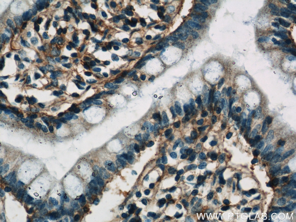 IHC staining of human small intestine using 55383-1-AP