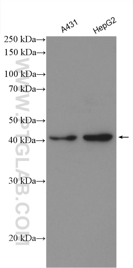 Western Blot (WB) analysis of various lysates using HLA-A Polyclonal antibody (55383-1-AP)