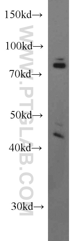 WB analysis of HeLa using 55383-1-AP