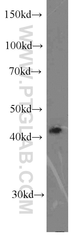 HLA-A Polyclonal antibody