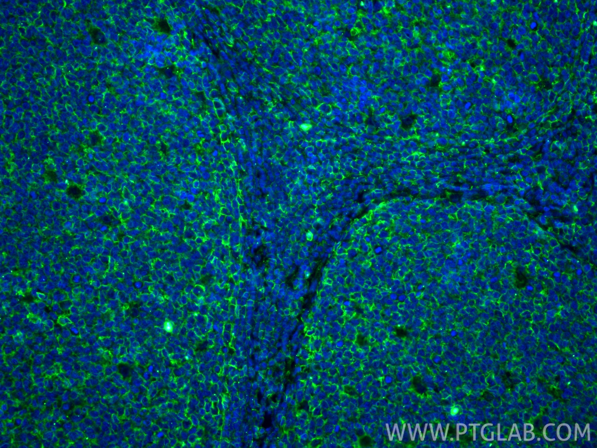 IF Staining of human tonsillitis using 66013-1-Ig Immunofluorescence (IF) / fluorescent staining of human tonsillitis tissue using HLA class I ABC Monoclonal antibody (66013-1-Ig)