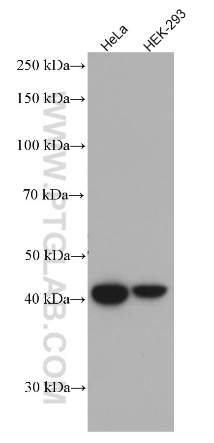 Western Blot (WB) analysis of various lysates using HLA class I ABC Monoclonal antibody (66013-1-Ig)