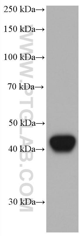 Western Blot (WB) analysis of human white blood using HLA class I ABC Monoclonal antibody (66013-1-Ig)