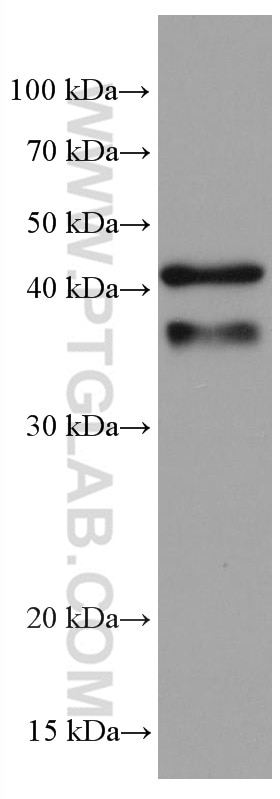 Western Blot (WB) analysis of pig spleen tissue using HLA class I ABC Monoclonal antibody (66013-1-Ig)