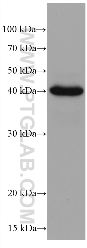 Western Blot (WB) analysis of NCCIT cells using HLA class I ABC Monoclonal antibody (66013-1-Ig)