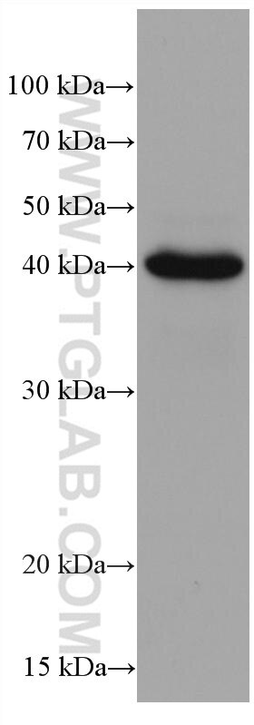 Western Blot (WB) analysis of NCCIT cells using HLA class I ABC Monoclonal antibody (66013-1-Ig)