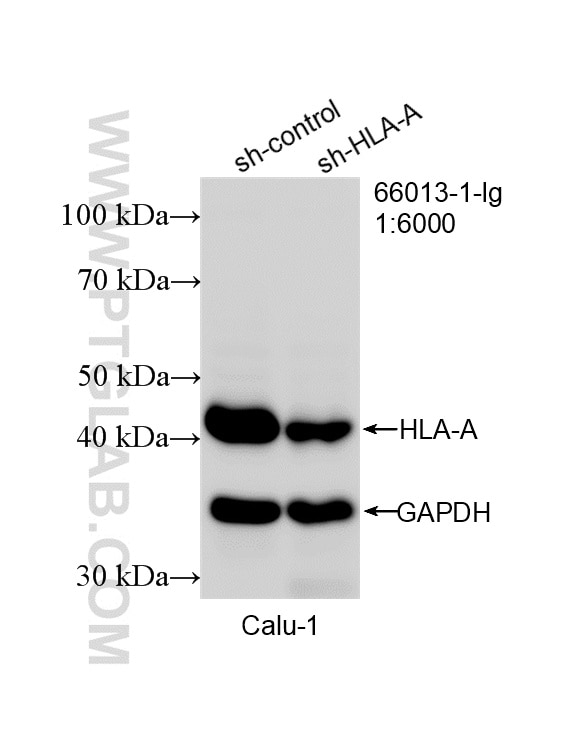 WB analysis of Calu-1 using 66013-1-Ig Western Blot (WB) analysis of Calu-1 cells using HLA class I ABC Monoclonal antibody (66013-1-Ig)