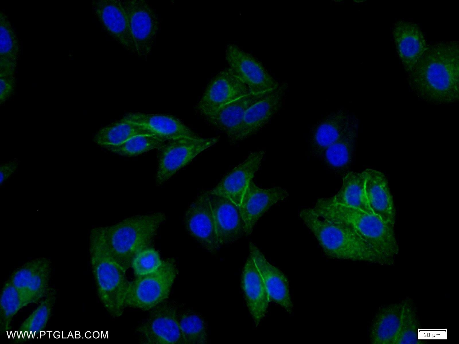 Immunofluorescence (IF) / fluorescent staining of HepG2 cells using HLA class I (HLA-B) Polyclonal antibody (17260-1-AP)