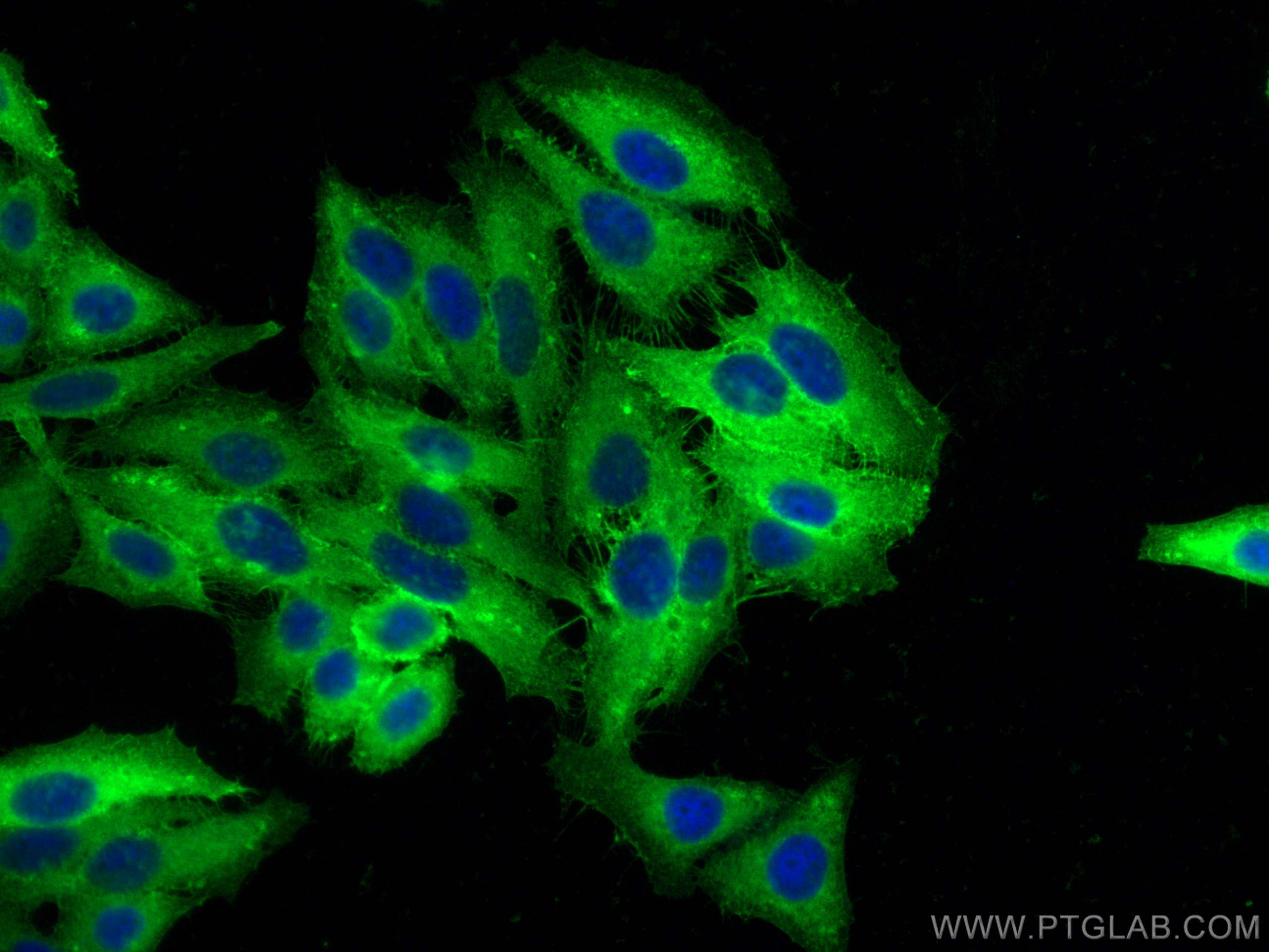 Immunofluorescence (IF) / fluorescent staining of HepG2 cells using HLA class I (HLA-B) Polyclonal antibody (17260-1-AP)