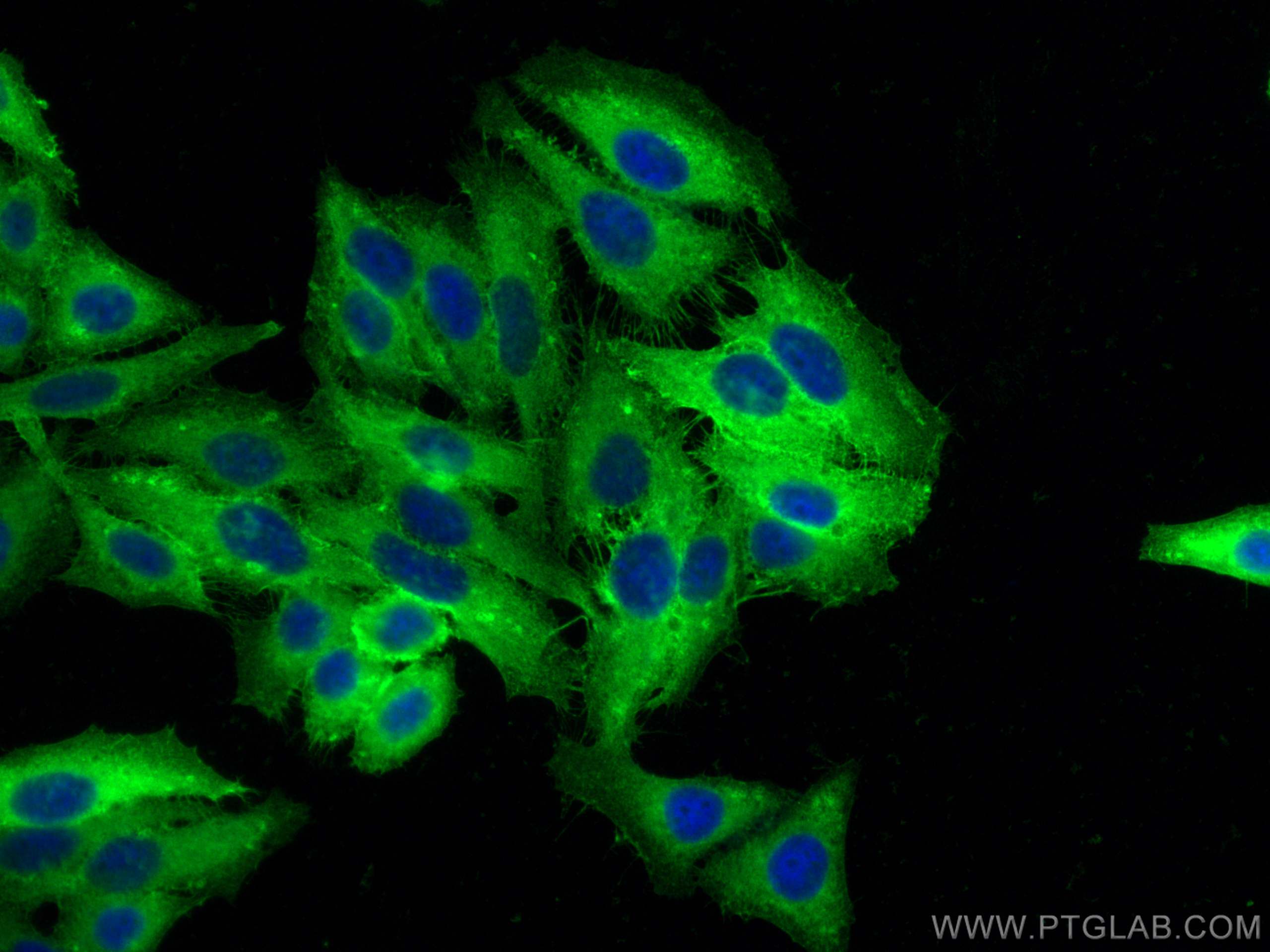 IF Staining of HepG2 using 17260-1-AP