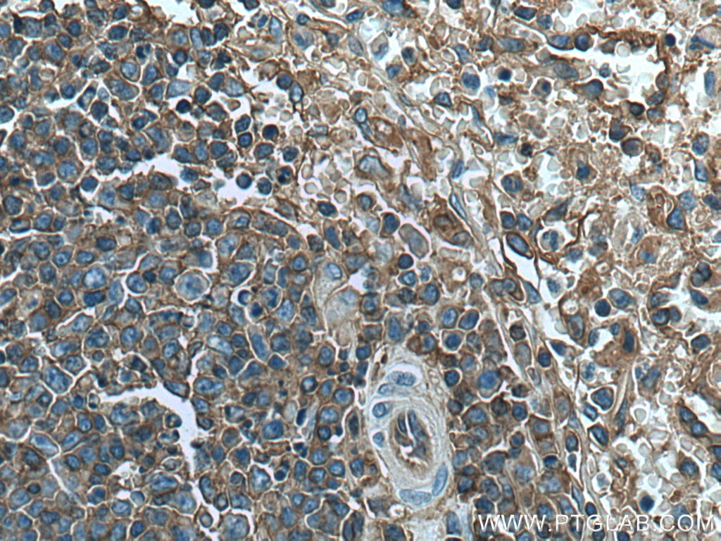 Immunohistochemistry (IHC) staining of human spleen tissue using HLA class I (HLA-B) Polyclonal antibody (17260-1-AP)