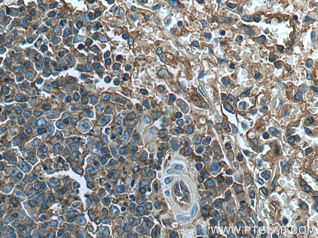 IHC staining of human spleen using 17260-1-AP