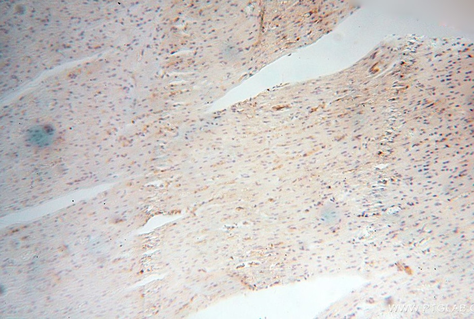 Immunohistochemistry (IHC) staining of human heart tissue using HLA class I (HLA-B) Polyclonal antibody (17260-1-AP)