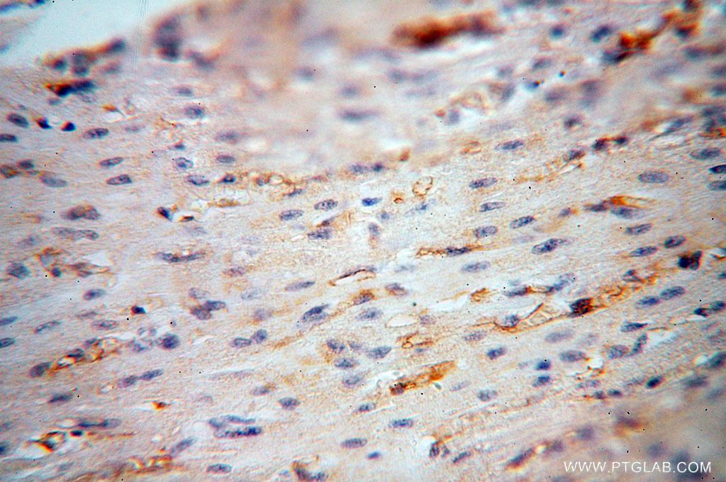 IHC staining of human heart using 17260-1-AP