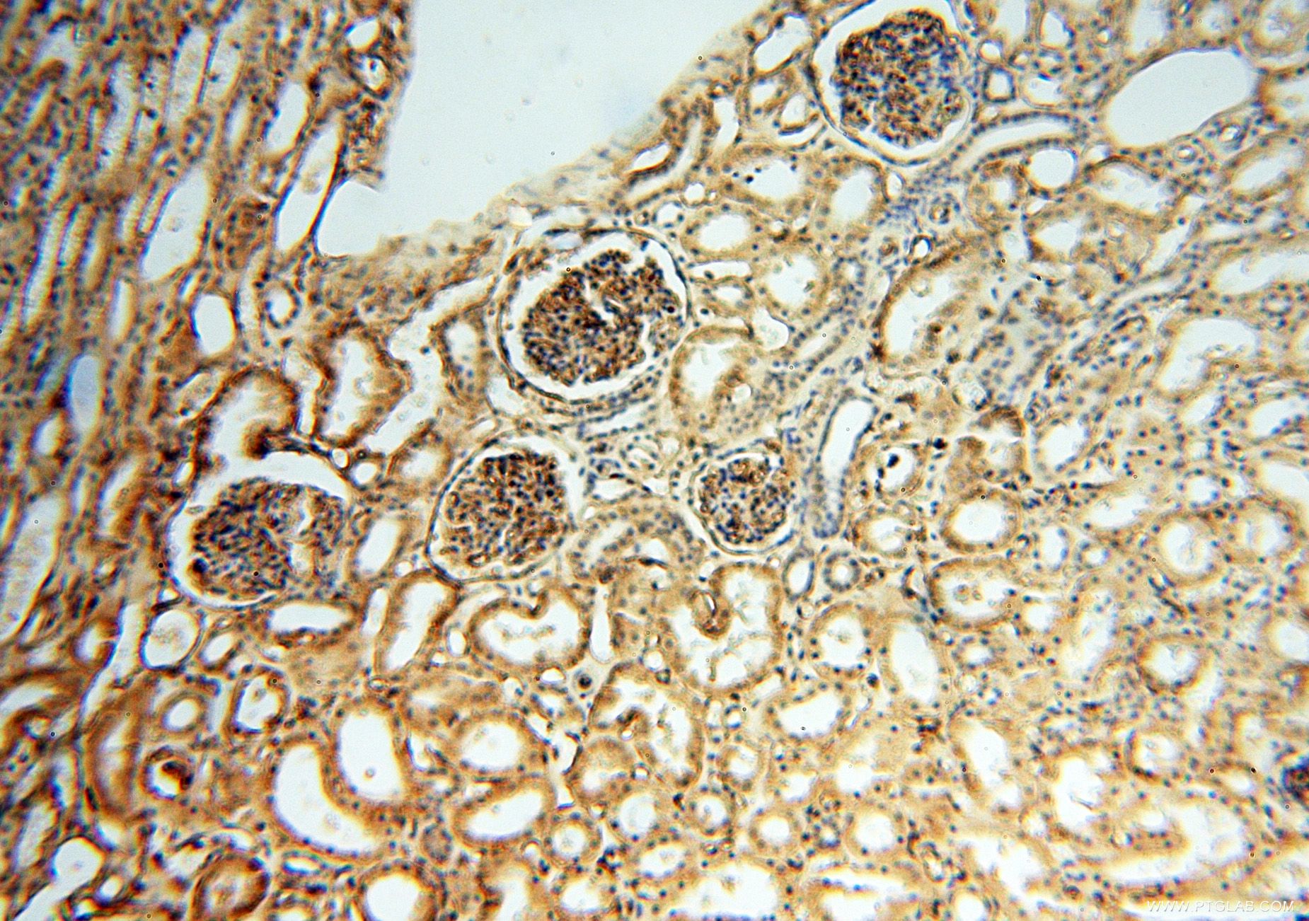 Immunohistochemistry (IHC) staining of human kidney tissue using HLA class I (HLA-B) Polyclonal antibody (17260-1-AP)
