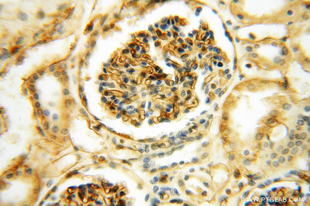 Immunohistochemistry (IHC) staining of human kidney tissue using HLA class I (HLA-B) Polyclonal antibody (17260-1-AP)