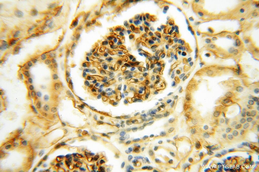 IHC staining of human kidney using 17260-1-AP