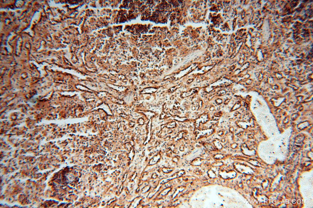 Immunohistochemistry (IHC) staining of human spleen tissue using HLA class I (HLA-B) Polyclonal antibody (17260-1-AP)