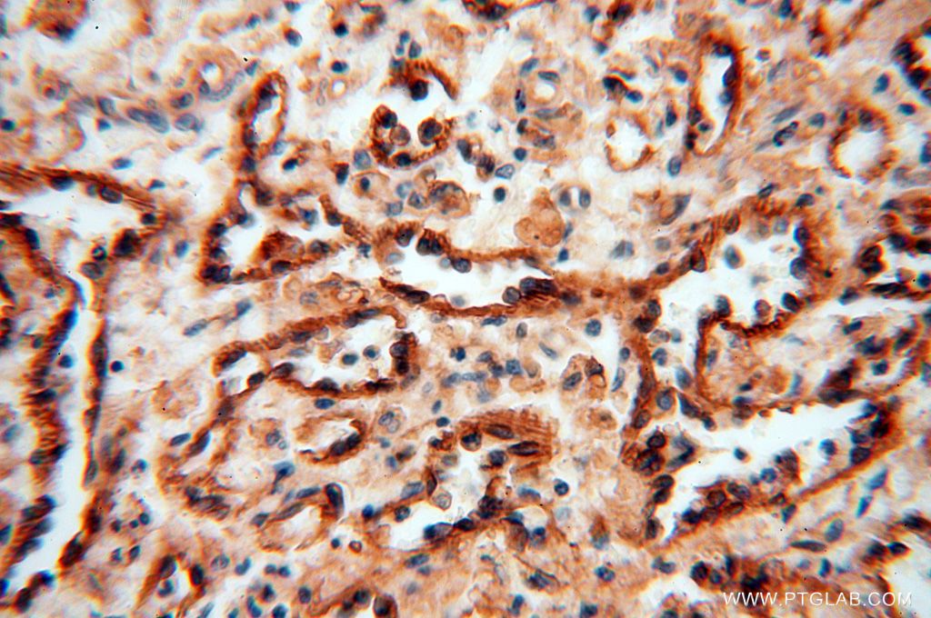 Immunohistochemistry (IHC) staining of human spleen tissue using HLA class I (HLA-B) Polyclonal antibody (17260-1-AP)