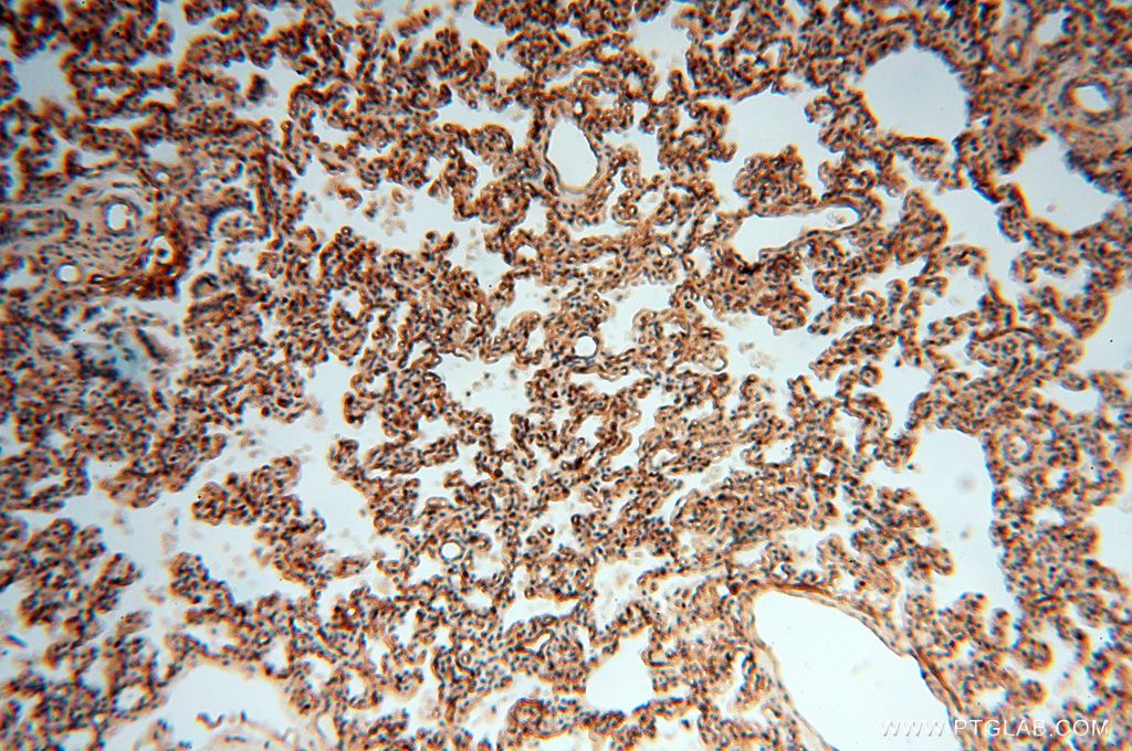 Immunohistochemistry (IHC) staining of human lung tissue using HLA class I (HLA-B) Polyclonal antibody (17260-1-AP)