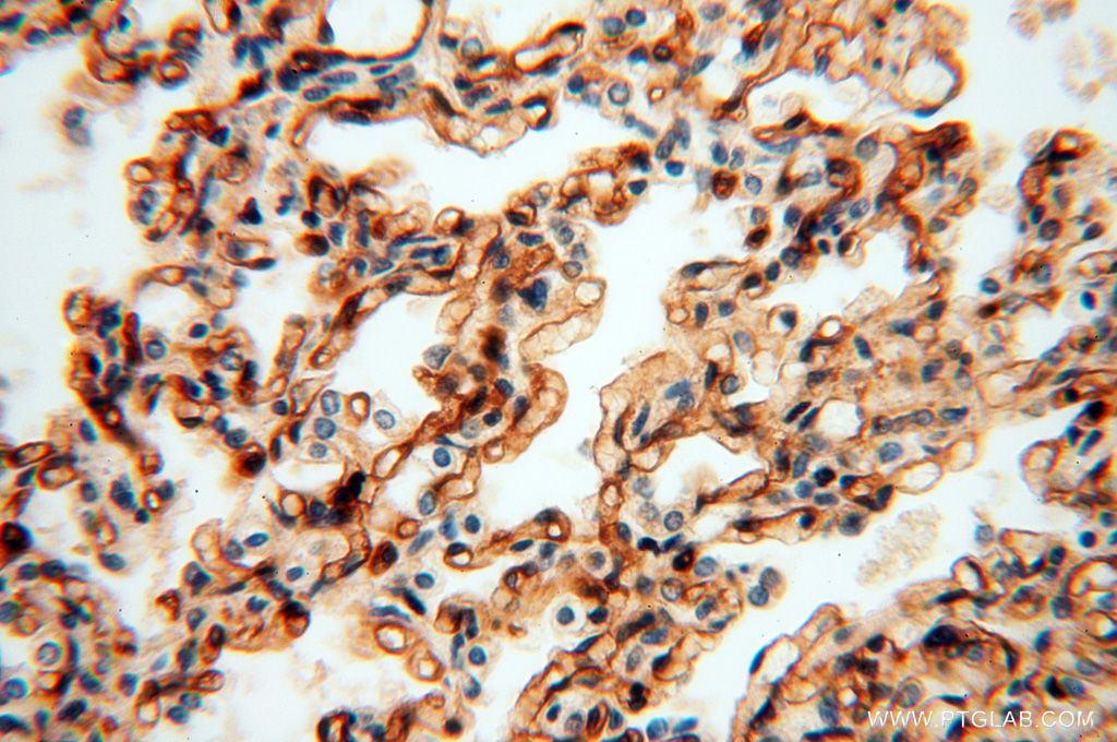 Immunohistochemistry (IHC) staining of human lung tissue using HLA class I (HLA-B) Polyclonal antibody (17260-1-AP)