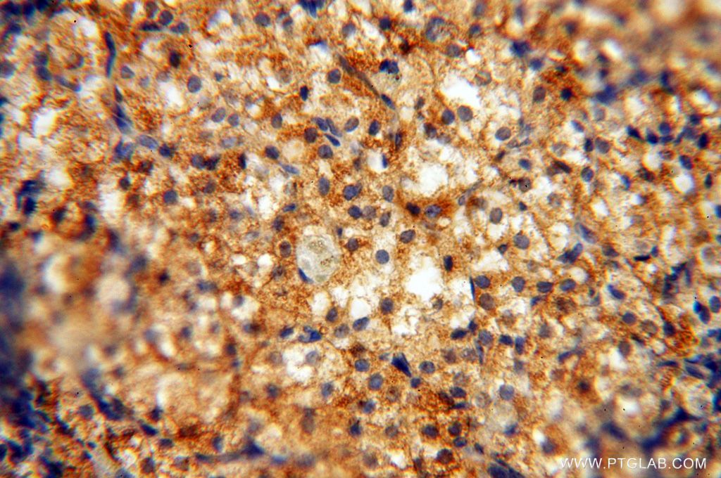 Immunohistochemistry (IHC) staining of human ovary tissue using HLA class I (HLA-B) Polyclonal antibody (17260-1-AP)