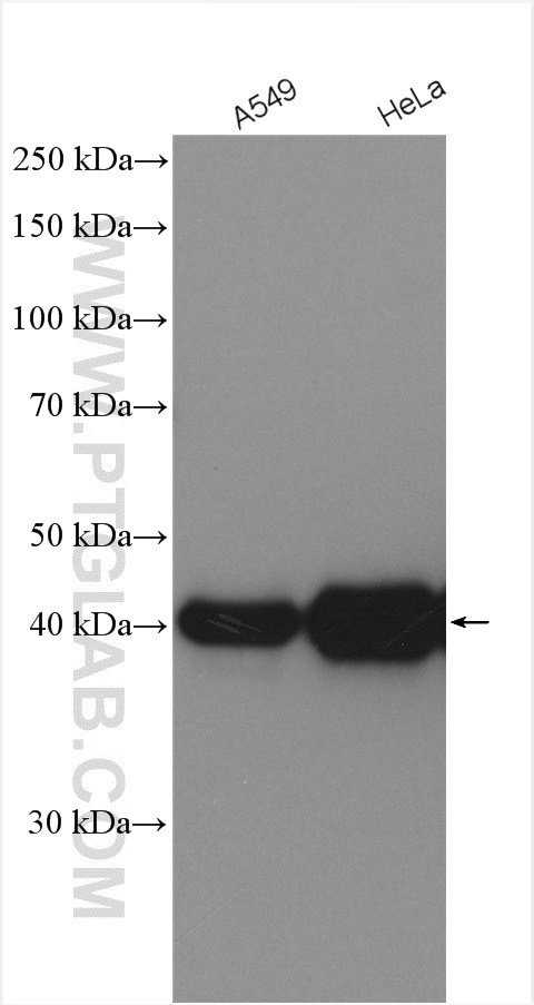 Western Blot (WB) analysis of various lysates using HLA class I (HLA-B) Polyclonal antibody (17260-1-AP)