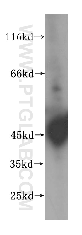 Western Blot (WB) analysis of MCF-7 cells using HLA class I (HLA-B) Polyclonal antibody (17260-1-AP)